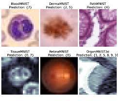 Comparing MLPs, CNNs, and Pre-trained MobileNetV2 for Organ Classification on the OrganAMNIST Dataset